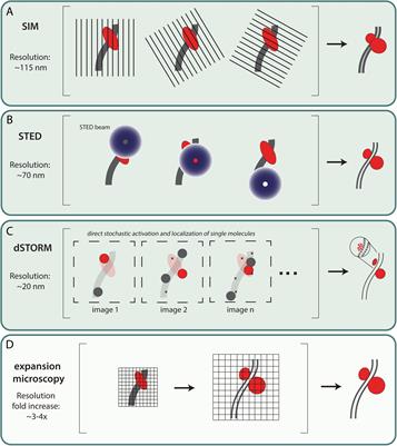 High Resolution View on the Regulation of Recombinase Accumulation in Mammalian Meiosis